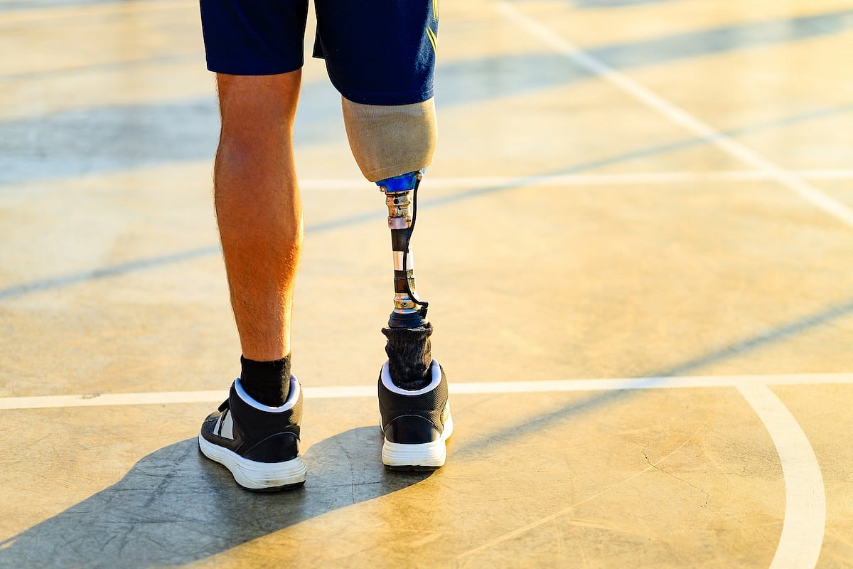 New Material Allows Amputees To Adjust Prosthetic Limb Fit Via ...